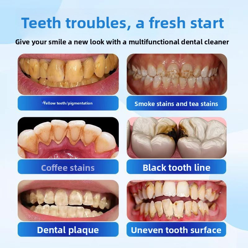 Ultrasonic Teeth Cleaning Polisher with 6 Heads